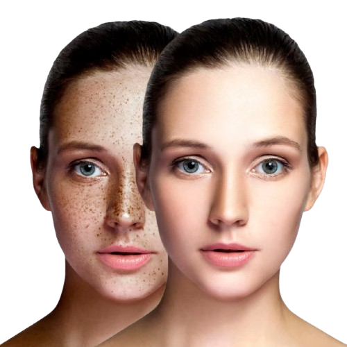 Lisar Hyperpigmentation Serum